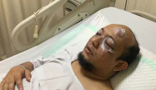 Usai Salat Subuh, Novel Baswedan Disiram Air Keras